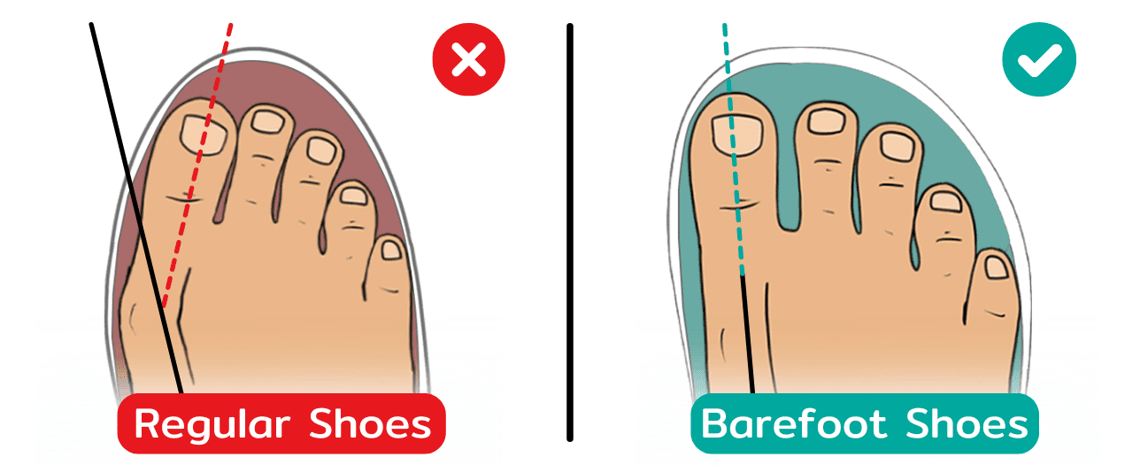 Narrow Vs Wide Toe Box Shoes